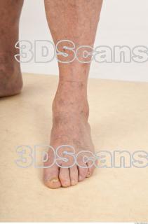 Photo reference of foot 0003